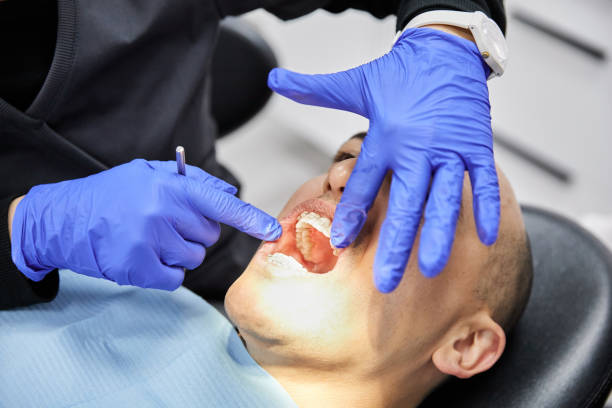 Best Dental Abscess Treatment in Gibsonville, NC